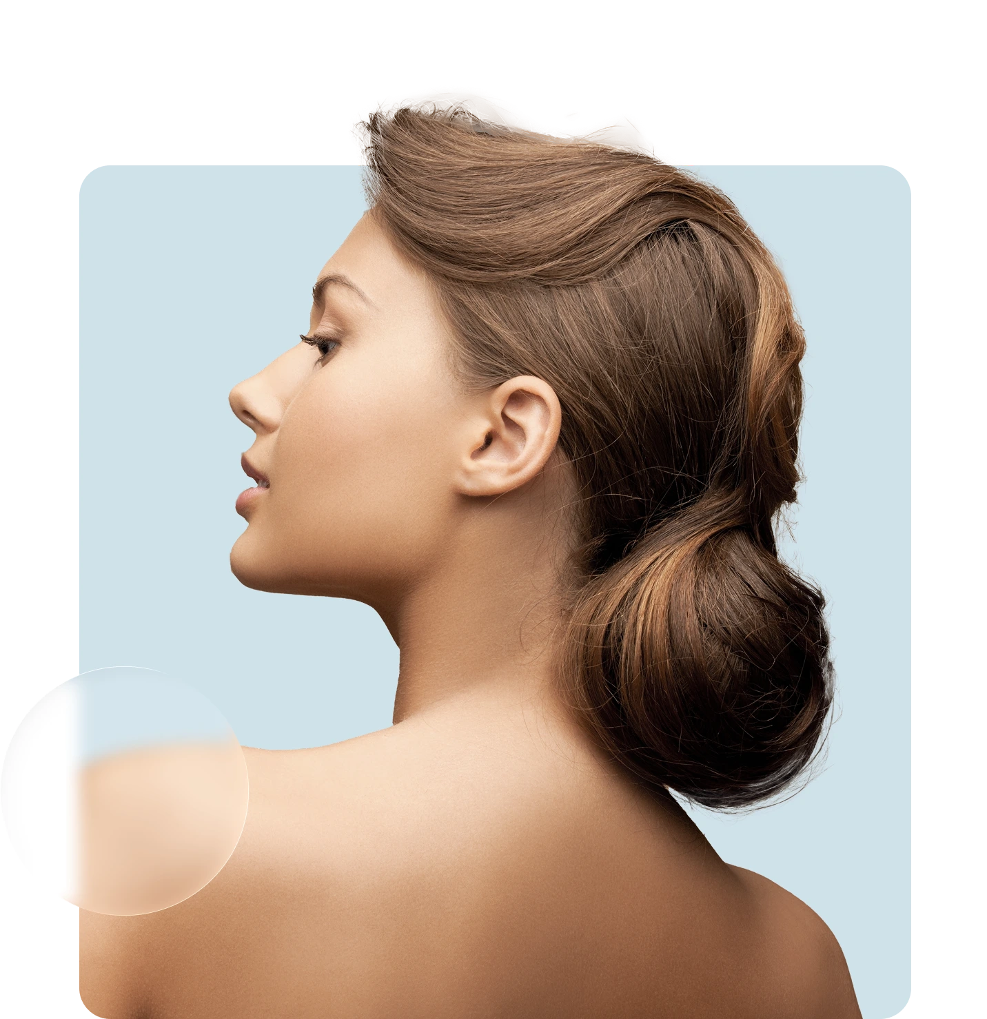 Antes de realizar rinoplastia ultrasónica Antes de realizar rinoplastia ultrasónica