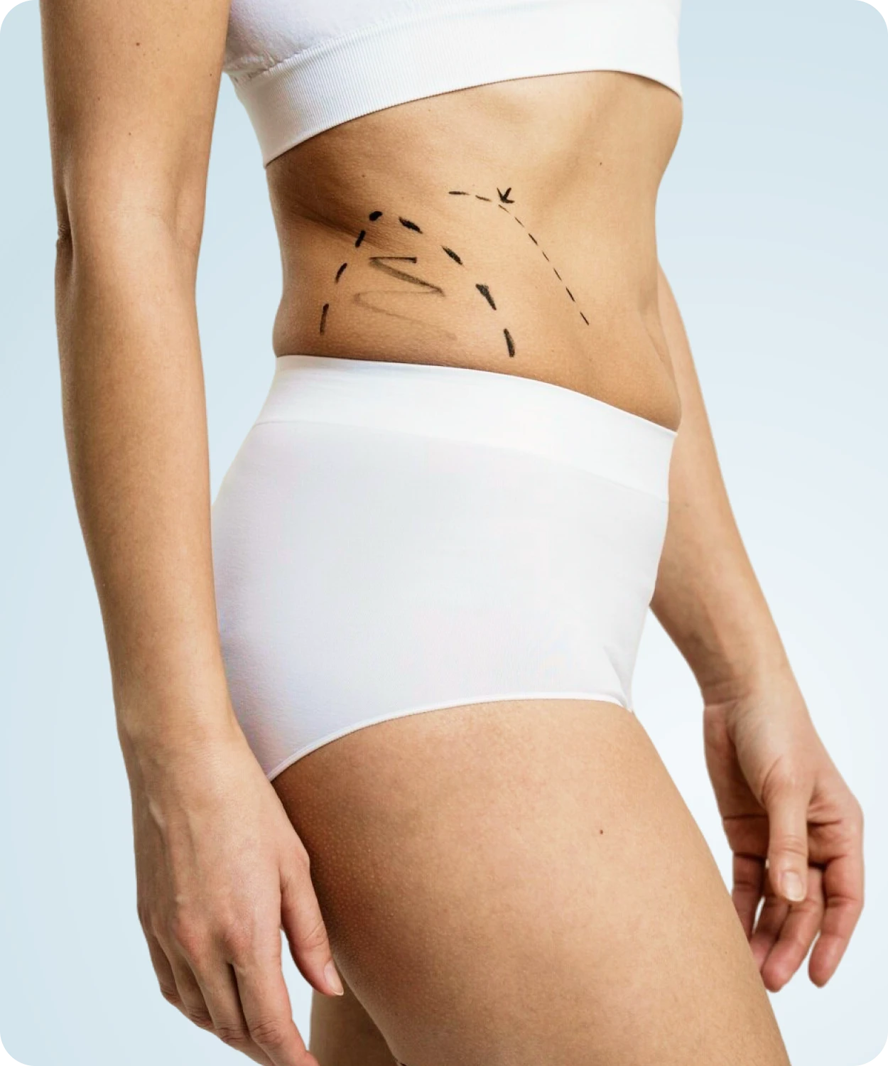 Como Funciona Bodytite