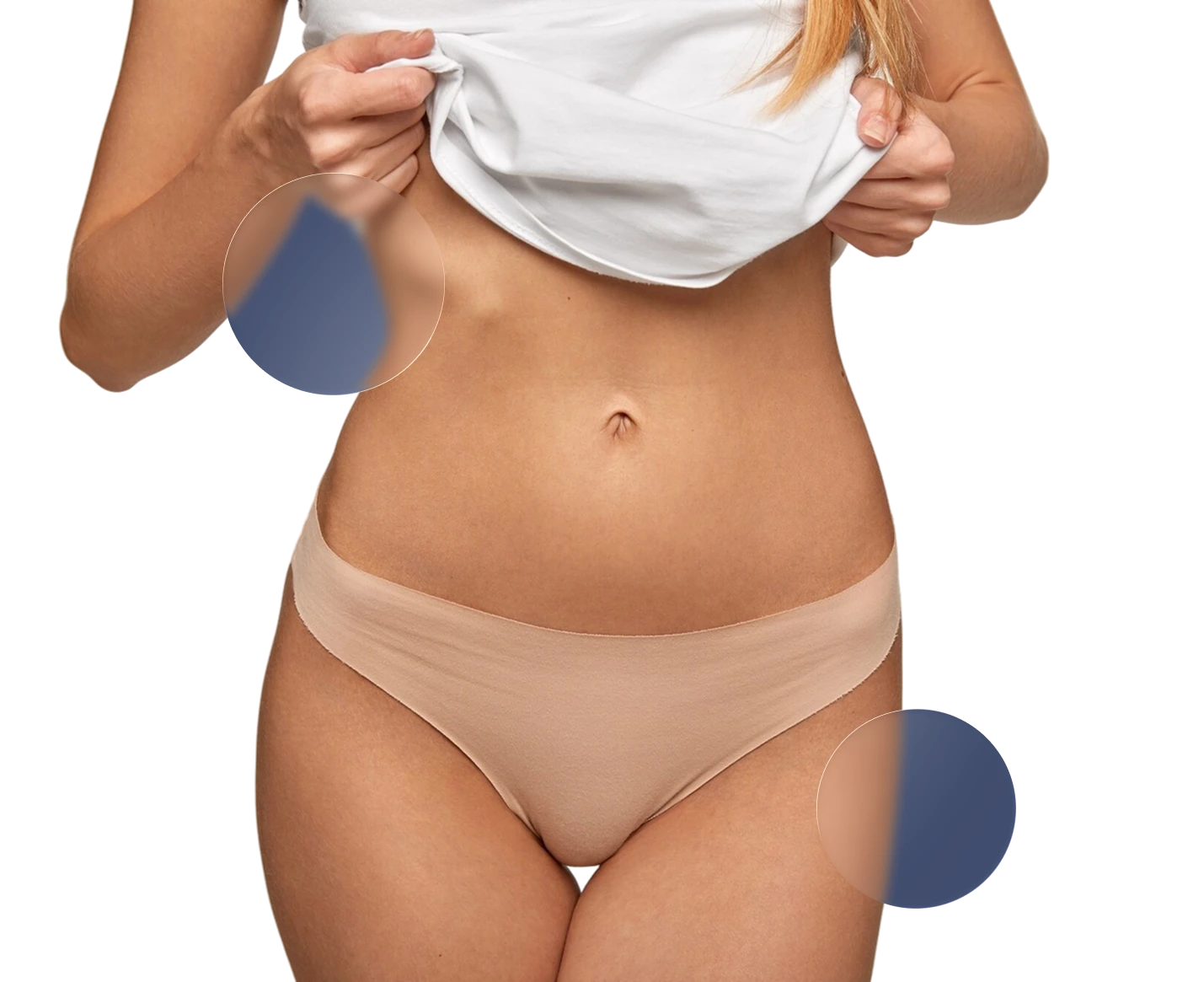 Labioplastia de aumento Labioplastia de aumento