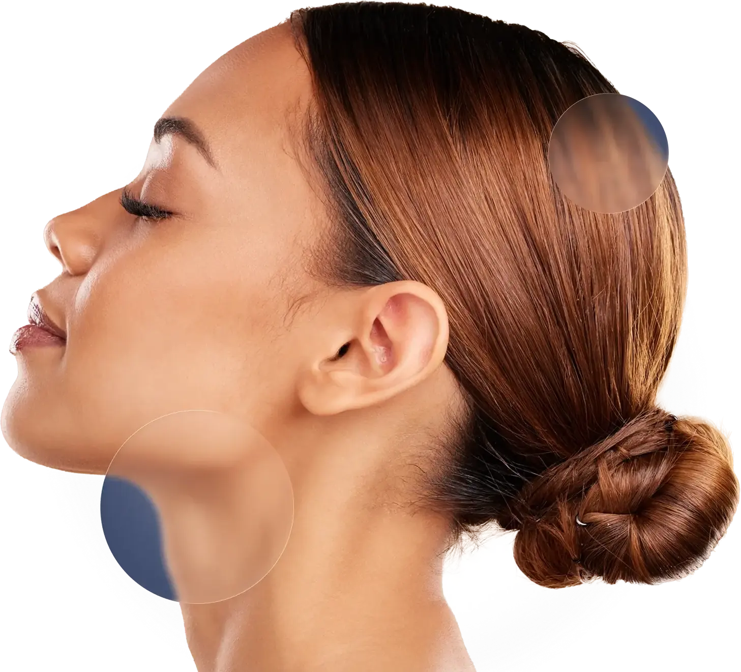 Otoplastia cirugía Barcelona