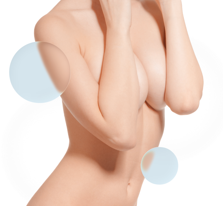 Recambio prótesis mama Barcelona Recambio prótesis mama Barcelona