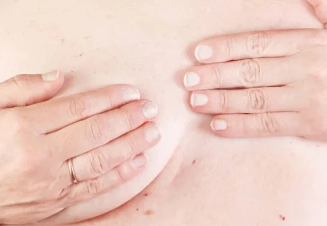 cirugia-reparadora-mamaria