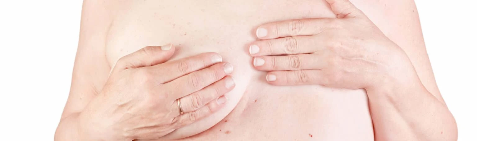 Cirugía reparadora mamaria