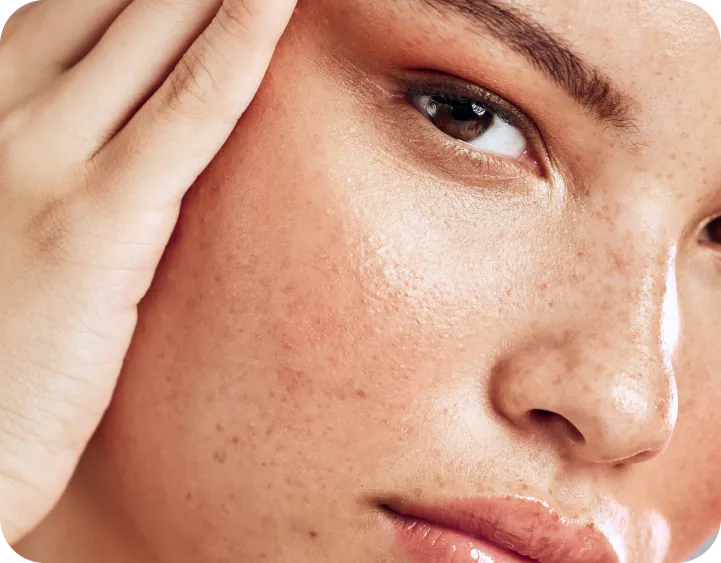 Efecto Lifting Global