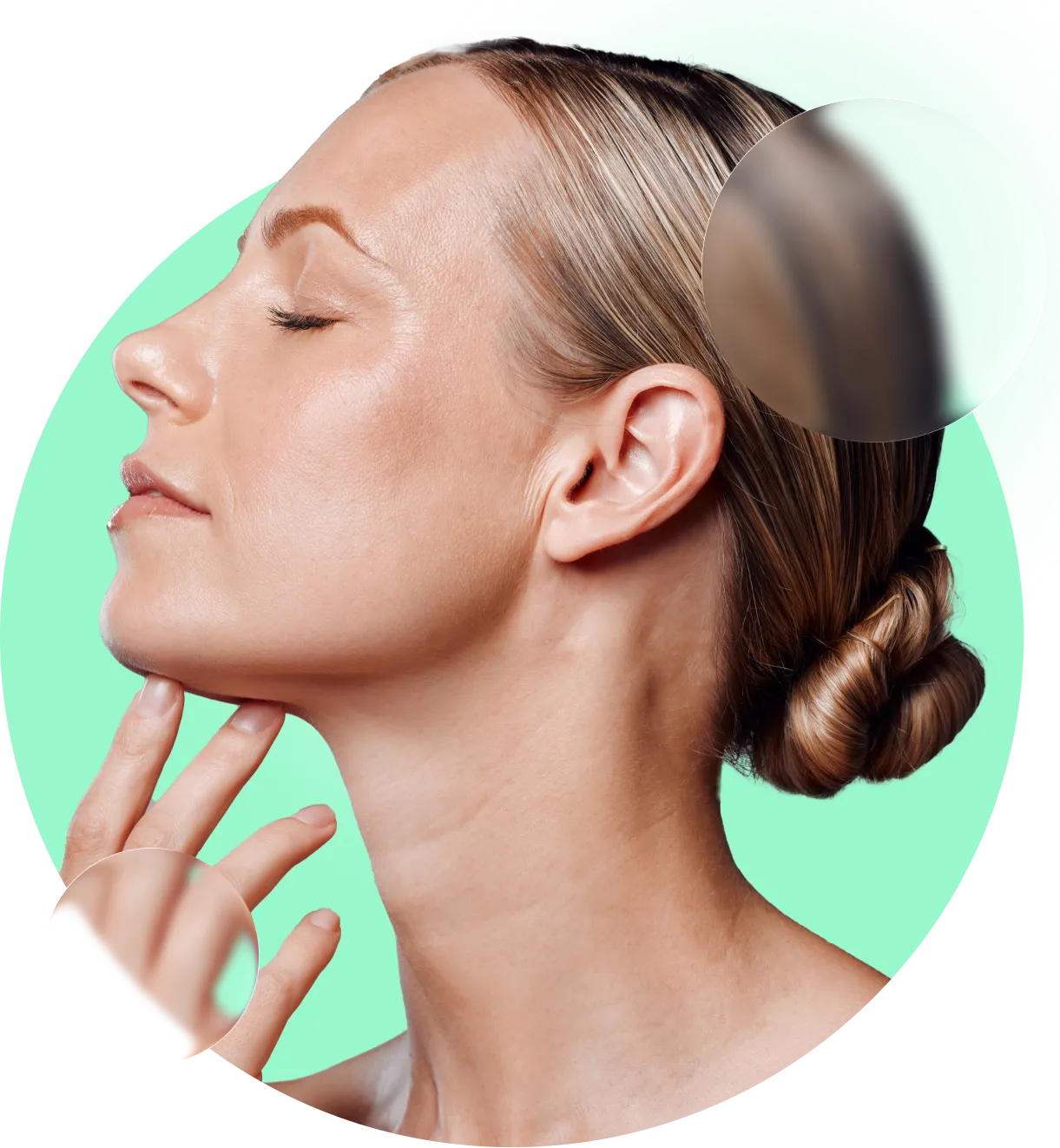 Cirugía estética facial lifting cervicofacial