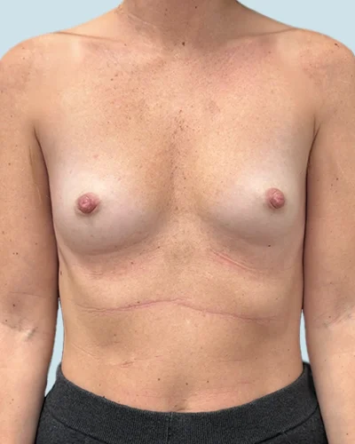 Mia Femtech antes y después