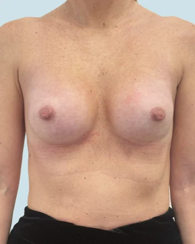 Mia Femtech antes y después