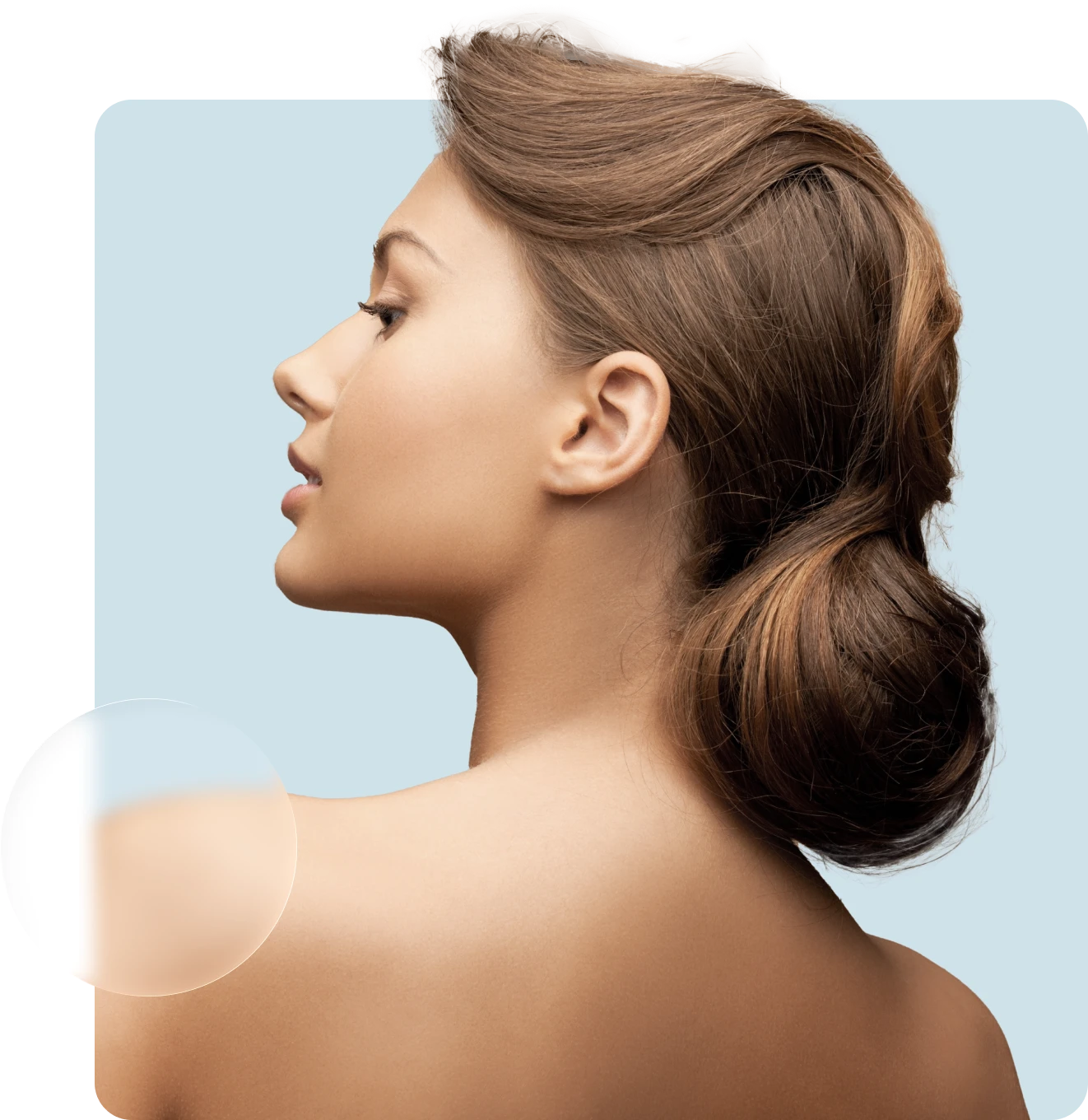 rinoplastia estructurada